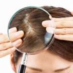 Comprehensive Guide to Scalp Therapy