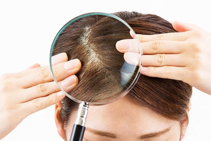 Comprehensive Guide to Scalp Therapy