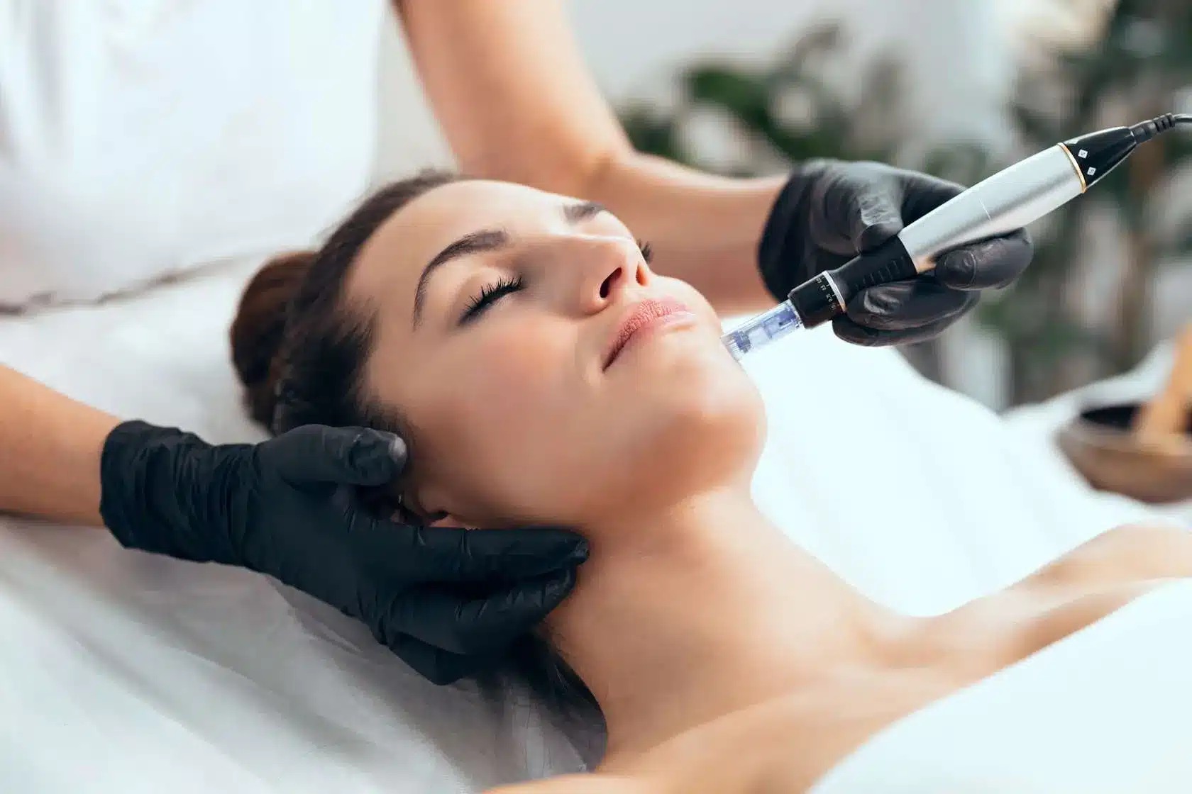 Hydra Needle Facial Treatment