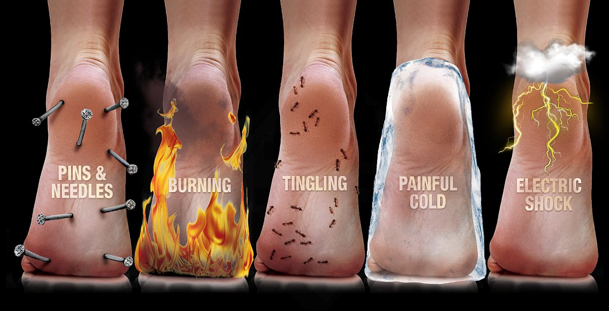 Illustration of ankle pain sensations: pins & needles, burning, tingling, cold, electric shock.