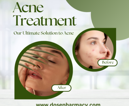 Does Isotretinoin Remove Acne Permanently?