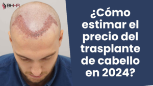 trasplante de cabello precio