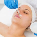 best chemical peels treatment in missouri city