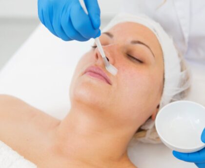 best chemical peels treatment in missouri city